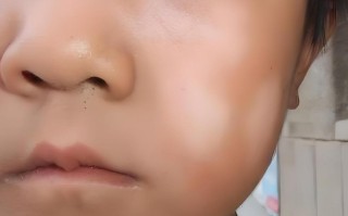 孩子脸色苍白没胃口，是贫血还是脾胃出问题了？