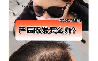 孕期脱发后，头发真的能重新长出来吗？需要多久才能恢复呢？