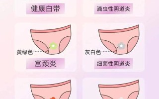 怀孕黄色分泌物正常吗？