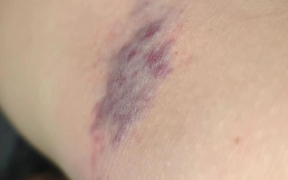 怀孕期间遭遇家暴，为何男友的拳头能挥向最该被保护的人？