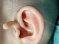 新生儿出生耳朵上有毛是正常现象还是健康异常？