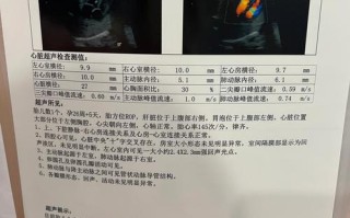 孕期心脏彩超能查出哪些胎儿问题？