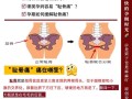 孕期下面骨头疼正常吗？可能是耻骨分离还是其他原因？