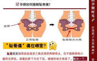 孕期下面骨头疼正常吗？可能是耻骨分离还是其他原因？