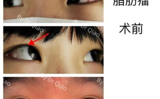 上海儿童医院眼科好吗