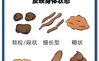 孕期大便次数多不成形是正常生理变化还是肠道疾病信号？
