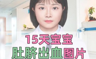 新生儿8天肚脐出血怎么办？