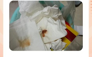 孕期痰中带血是身体发出的危险信号吗？需警惕哪些孕期疾病隐患？