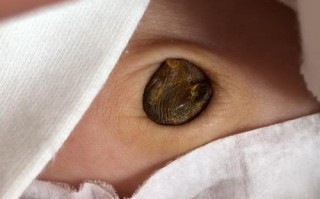 新生儿脐带未脱落且发白是正常现象还是异常信号？