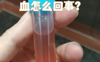 儿童孤立性血尿随访中，需警惕哪些潜在风险与干预时机？