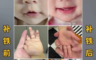 11岁儿童贫血的症状