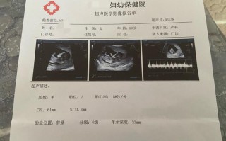 孕期12周必做检查有哪些？关键项目及注意事项详解