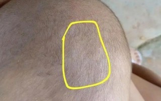 新生儿头顶卤门不跳动是正常现象还是异常信号？需警惕哪些潜在问题？