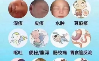 新生儿奶粉不耐受有哪些表现？