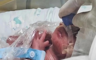 新生儿监护室一天费用究竟多少？不同地区、病情差异会影响收费吗？