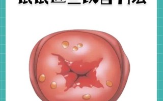 孕期发现宫颈囊肿，会对胎儿有影响吗？需要治疗吗？