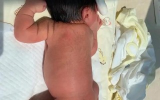 新生儿黄疸400多会伤脑吗？