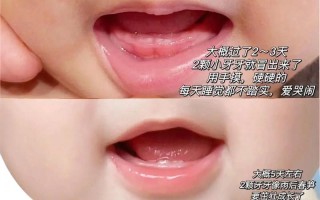 新生儿牙龈正常状态是怎样的？标准牙龈图片显示什么特征？