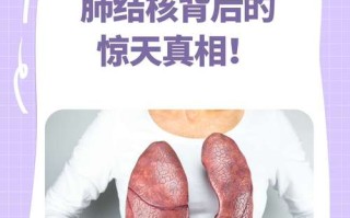 孕期患肺结核，胎儿健康怎么办？