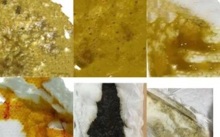 新生儿大便有粘液和奶瓣是消化不良还是生病了？