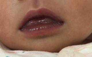 新生儿嘴发紫是缺氧吗？