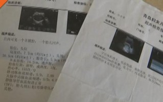 整个孕期到底能做几次B超？做多了会对宝宝有影响吗？