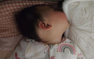 新生儿仰头是发育信号还是异常表现？家长该如何正确判断与应对？