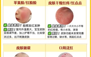 新生儿脸上反复长湿疹，到底该如何科学护理与治疗？