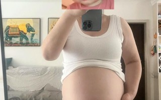 孕期脸部浮肿与胎儿性别有关联吗？科学依据是什么？