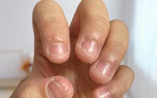 儿童咬指甲是什么原因