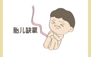 自闭症胎儿在孕期有什么表现