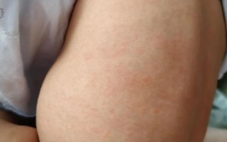 新生儿心肌炎早期症状隐匿，家长该如何捕捉这些不易察觉的信号？