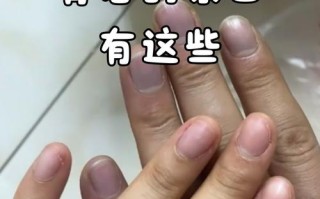 新生儿指甲发紫红是缺氧还是血液循环异常？附图片对比分析