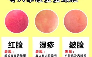 新生儿脸上红斑怎么办？是正常现象还是需要警惕的皮肤问题？
