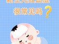 新生儿败血症最常见感染途径是什么？