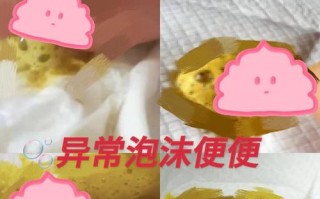 新生儿宝宝粑粑有泡泡是消化问题还是喂养方式需要调整？
