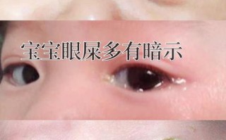 新生儿一只眼睛眼屎多又黄粘稠怎么办？