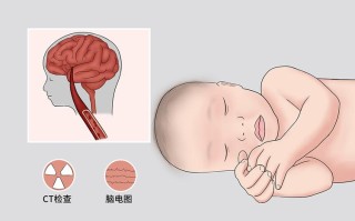 新生儿缺氧缺血性脑病后遗症