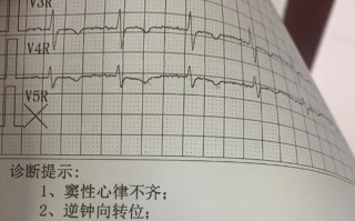 孕期心电图检查具体是查什么的？对胎儿有影响吗？