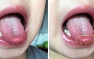 新生儿舌头总是往上翘是正常现象还是异常信号？需要干预吗？