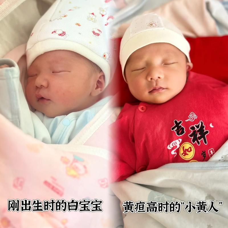 新生儿黄疸高峰期是出生后第几天？-第2张图片-中州医学会