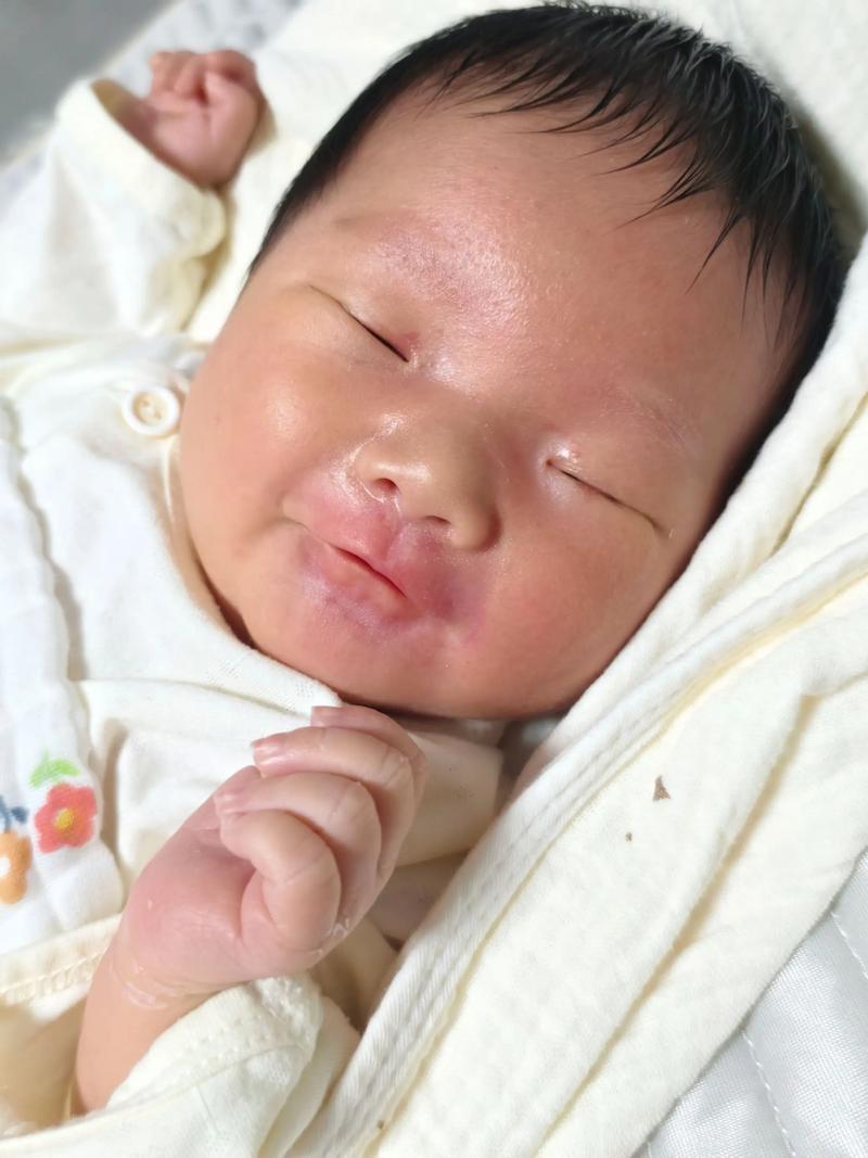 新生儿黄疸高峰期是出生后第几天？-第3张图片-中州医学会