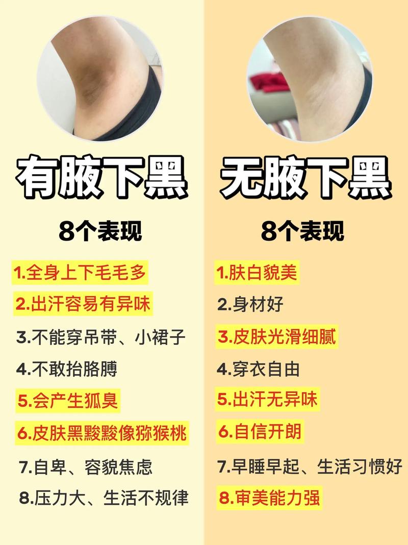 孕期腋下变黑能辨胎儿性别吗？-第1张图片-中州医学会