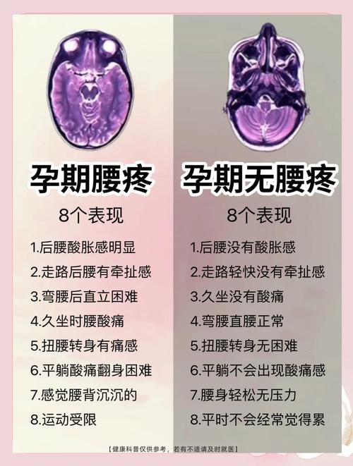 孕期坐骨神经痛如何缓解？-第3张图片-中州医学会