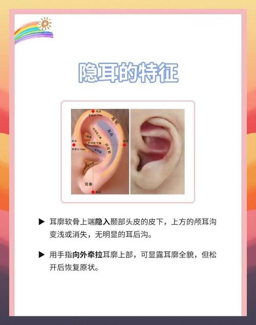 新生儿两耳大小不一怎么办？-第2张图片-中州医学会