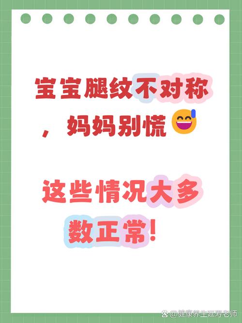 新生儿腿纹不对称，是异常信号吗？-第3张图片-中州医学会