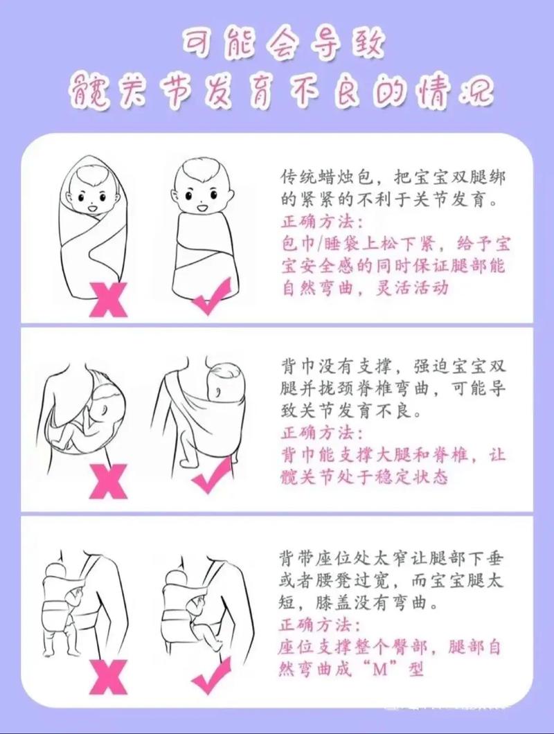 新生儿腿纹不对称，是异常信号吗？-第1张图片-中州医学会