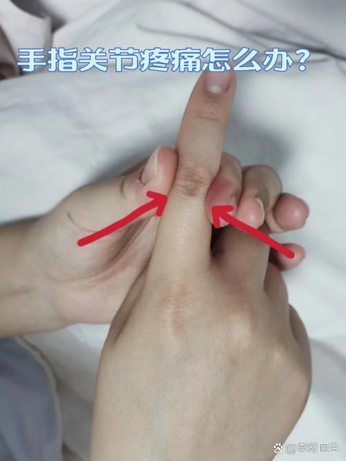 孕期手指关节疼是何原因？-第1张图片-中州医学会