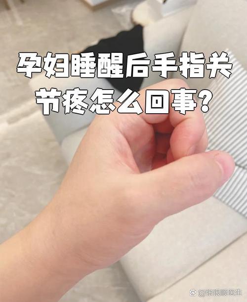 孕期手指关节疼是何原因？-第2张图片-中州医学会