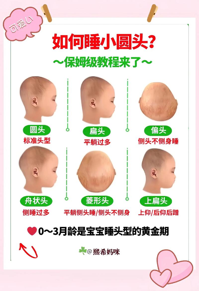 新生儿睡觉头总歪一边，正常吗？-第2张图片-中州医学会
